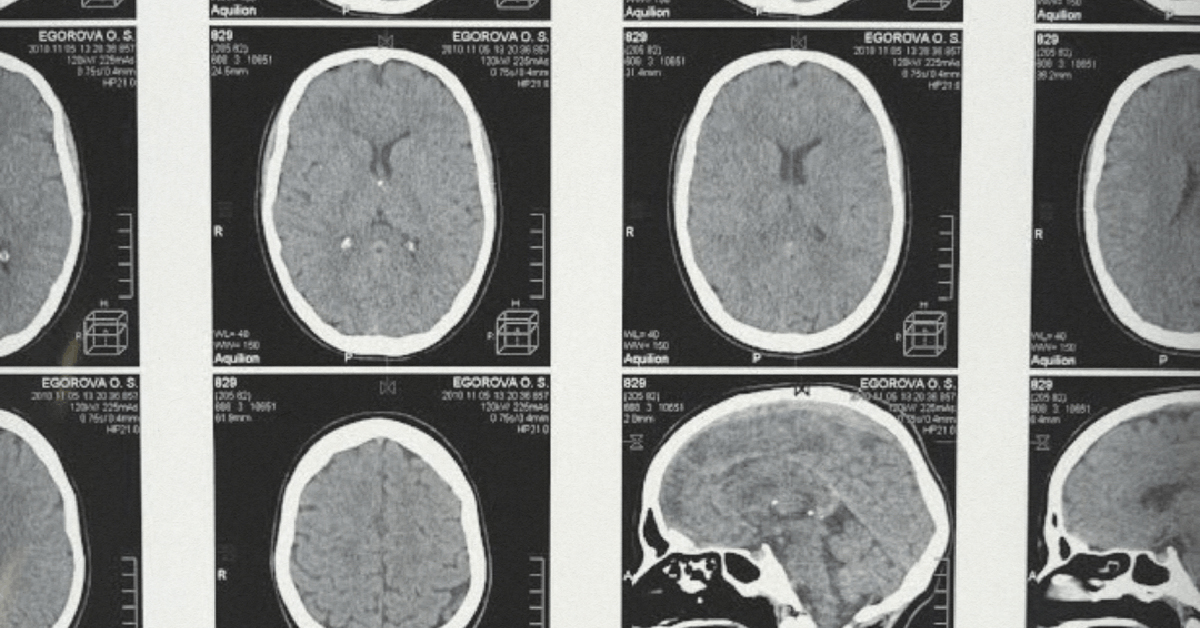 How Social Media Impacts the Brain
